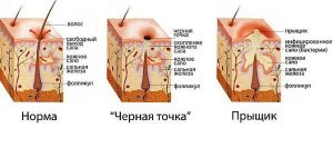 схема освіти чорних крапок