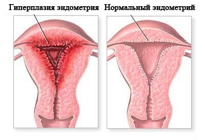 Шавлія - ​​лікувальні властивості для здоров'я дітей, чоловіків і жінок. Користь і як приймати