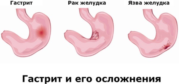 Деревій звичайний - корисні, лікувальні властивості та протипоказання для жінок, чоловіків і дітей