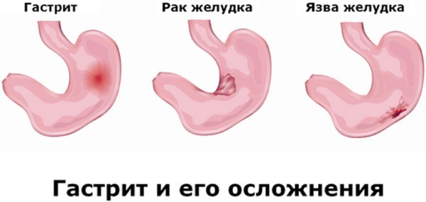 Репешок. Корисні, лікувальні властивості та протипоказання. Що лікує звичайний репешок. фото